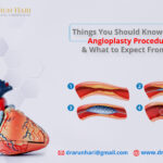 Angioplasty Procedure & What to Expect From It?