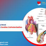 Everything You Need to Know About Cardiac Catheterization!