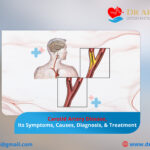 Carotid Artery Disease, Its Symptoms, Causes, Diagnosis, & Treatment!