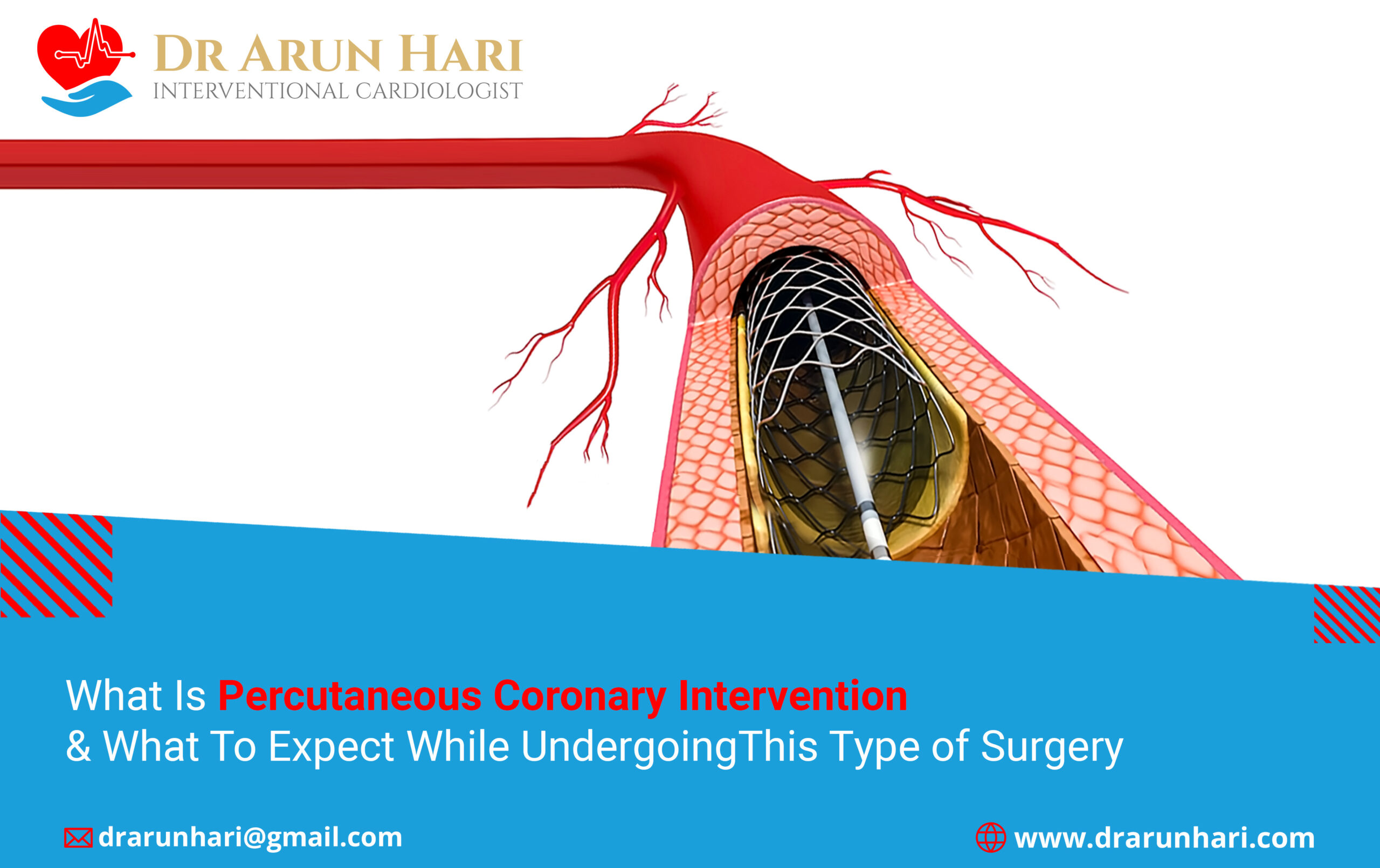 Read more about the article What Is Percutaneous Coronary Intervention & What To Expect While Undergoing This Type of Procedure?