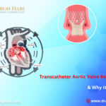 What Is Transcatheter Aortic Valve Replacement / TAVR & Why It Is Needed?