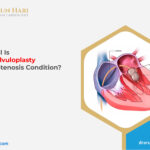 Balloon Valvuloplasty for Mitral Stenosis – How Useful Is It?