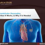 Biventricular Pacemaker – Benefits, How It Works, & Why It’s Needed?