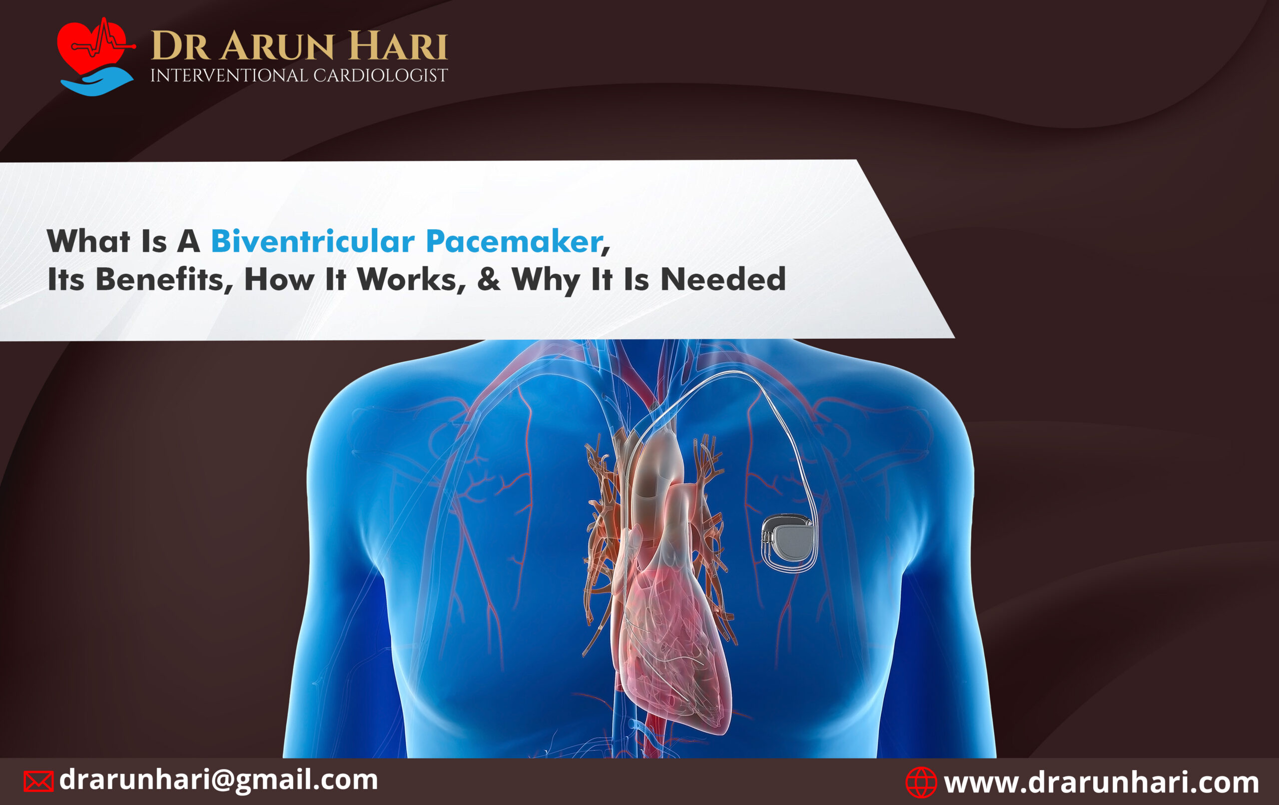 Read more about the article Biventricular Pacemaker – Benefits, How It Works, & Why It’s Needed?