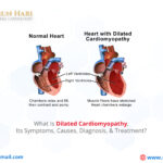 What Is Dilated Cardiomyopathy, Its Symptoms, Causes, Diagnosis, & Treatment?