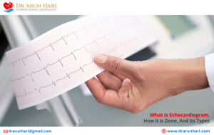 Read more about the article What Is Echocardiogram, How Is It Done, And Its Types?