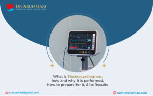 Read more about the article Electrocardiogram – How & Why It Is Performed, How to Prepare, & Results