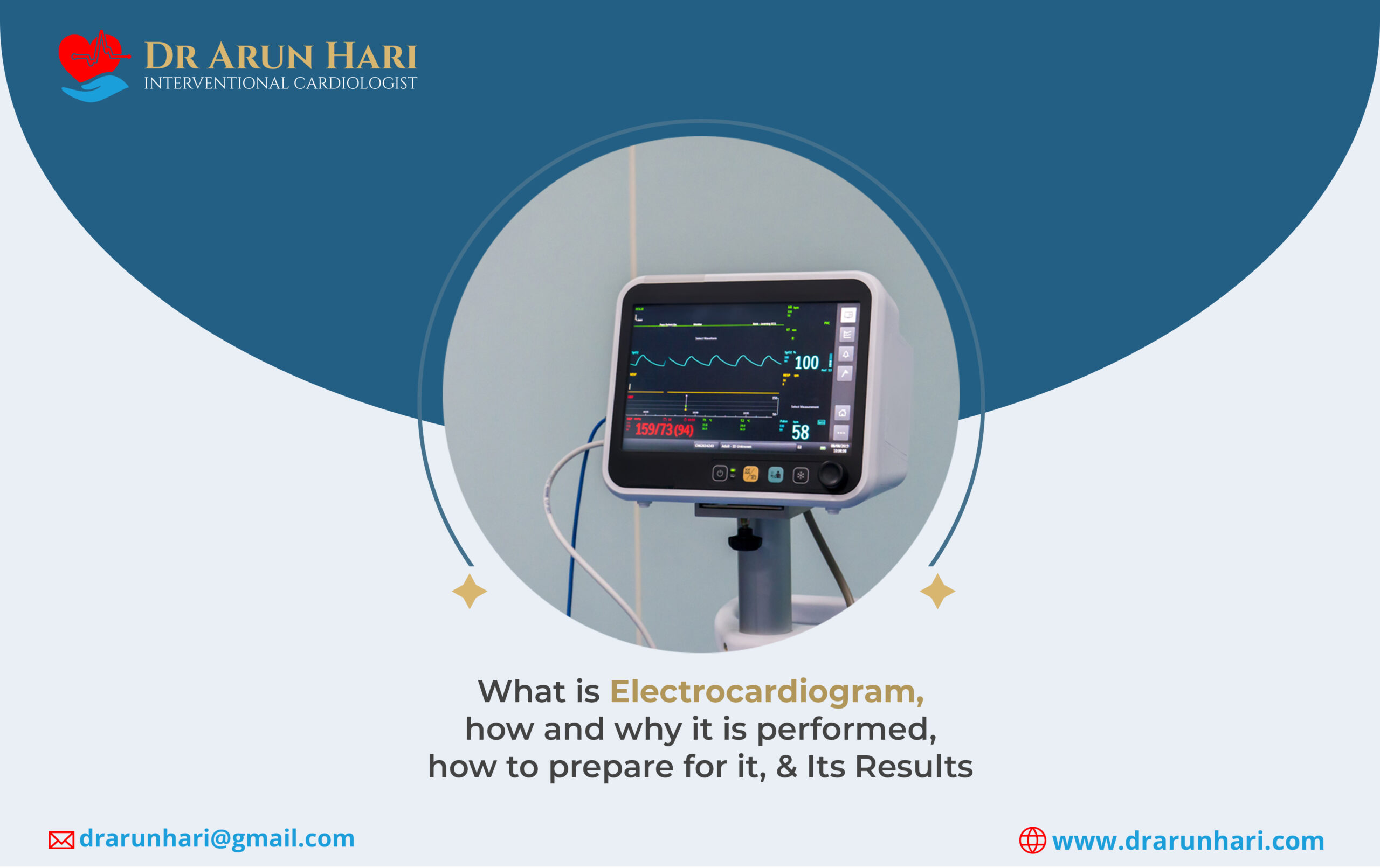 You are currently viewing Electrocardiogram – How & Why It Is Performed, How to Prepare, & Results