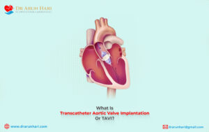 Read more about the article What Is Transcatheter Aortic Valve Implantation Or TAVI?