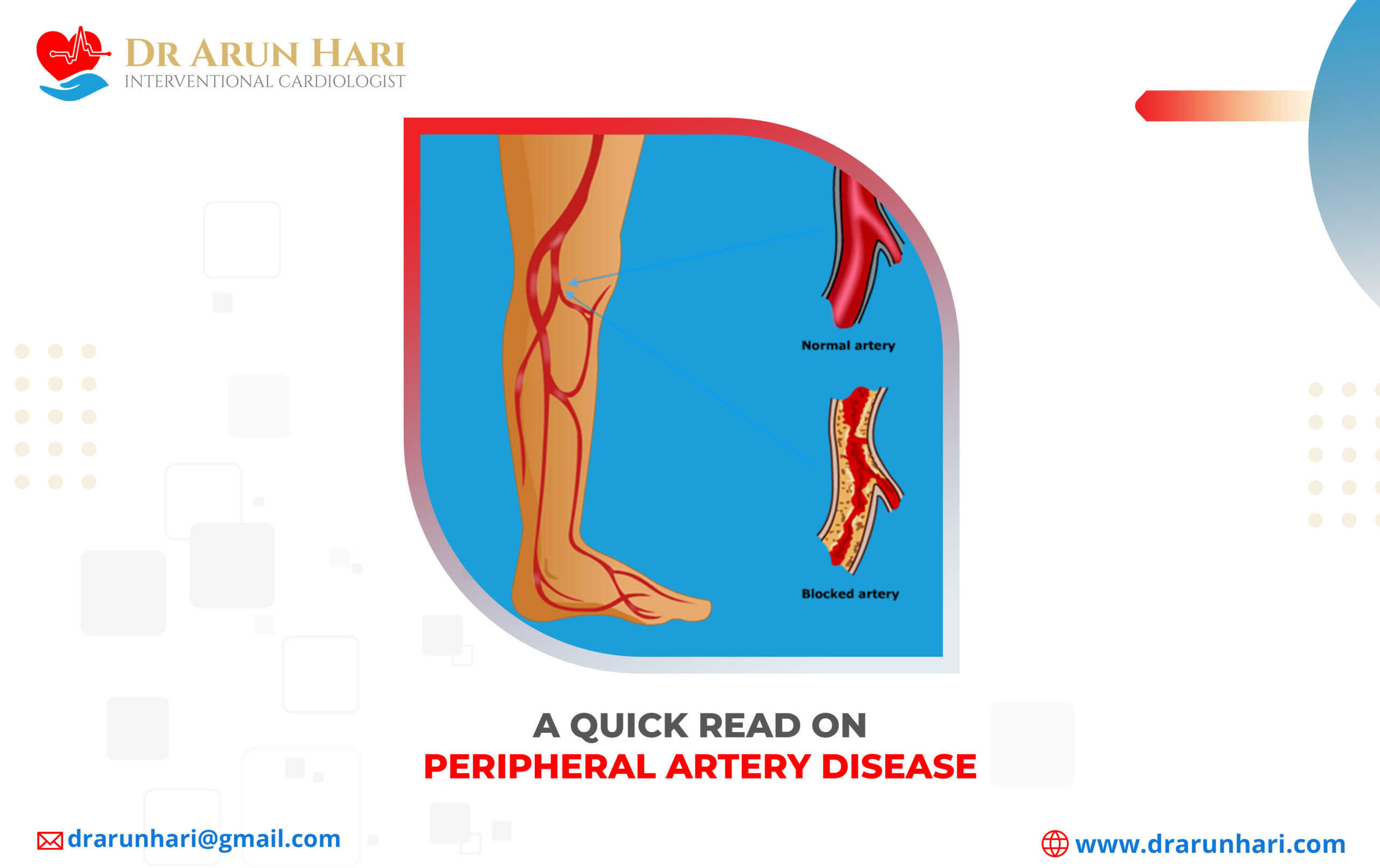 Read more about the article A Quick Read on Peripheral Artery Disease