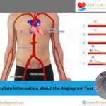 Get Complete Information about the Angiogram Test