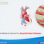 Seek the Best Medical Advice for Amyloid Heart Disease