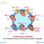 Cardiovascular Diseases: Leading Cause of Premature Deaths Globally