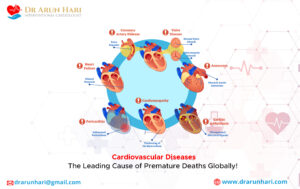 Read more about the article Cardiovascular Diseases: Leading Cause of Premature Deaths Globally