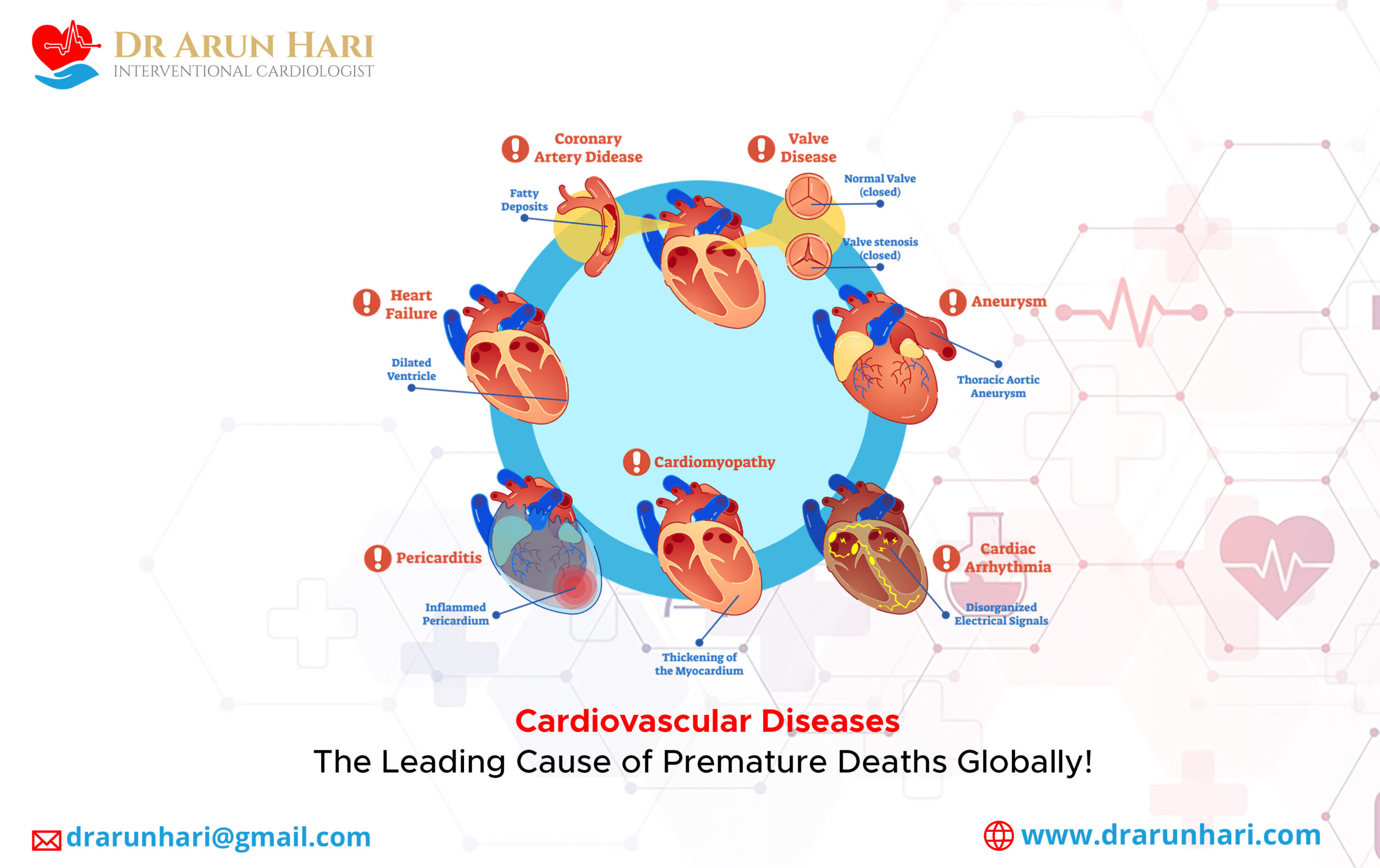 Read more about the article Cardiovascular Diseases – The Leading Cause of Premature Deaths Globally!
