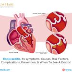 Endocarditis: Symptoms, Causes, Risks, Prevention, & When To See a Doctor