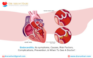 Read more about the article Endocarditis, Its symptoms, Causes, Risk Factors, Complications, Prevention, & When To See A Doctor!