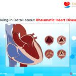 Talking in Detail about Rheumatic Heart Disease