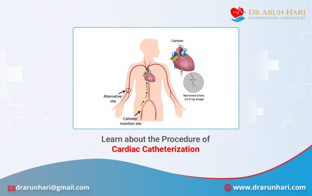 Learn about the Procedure of Cardiac Catheterization