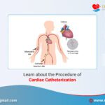 Learn about the Procedure of Cardiac Catheterization