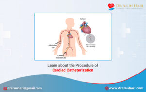 Read more about the article Learn about the Procedure of Cardiac Catheterization