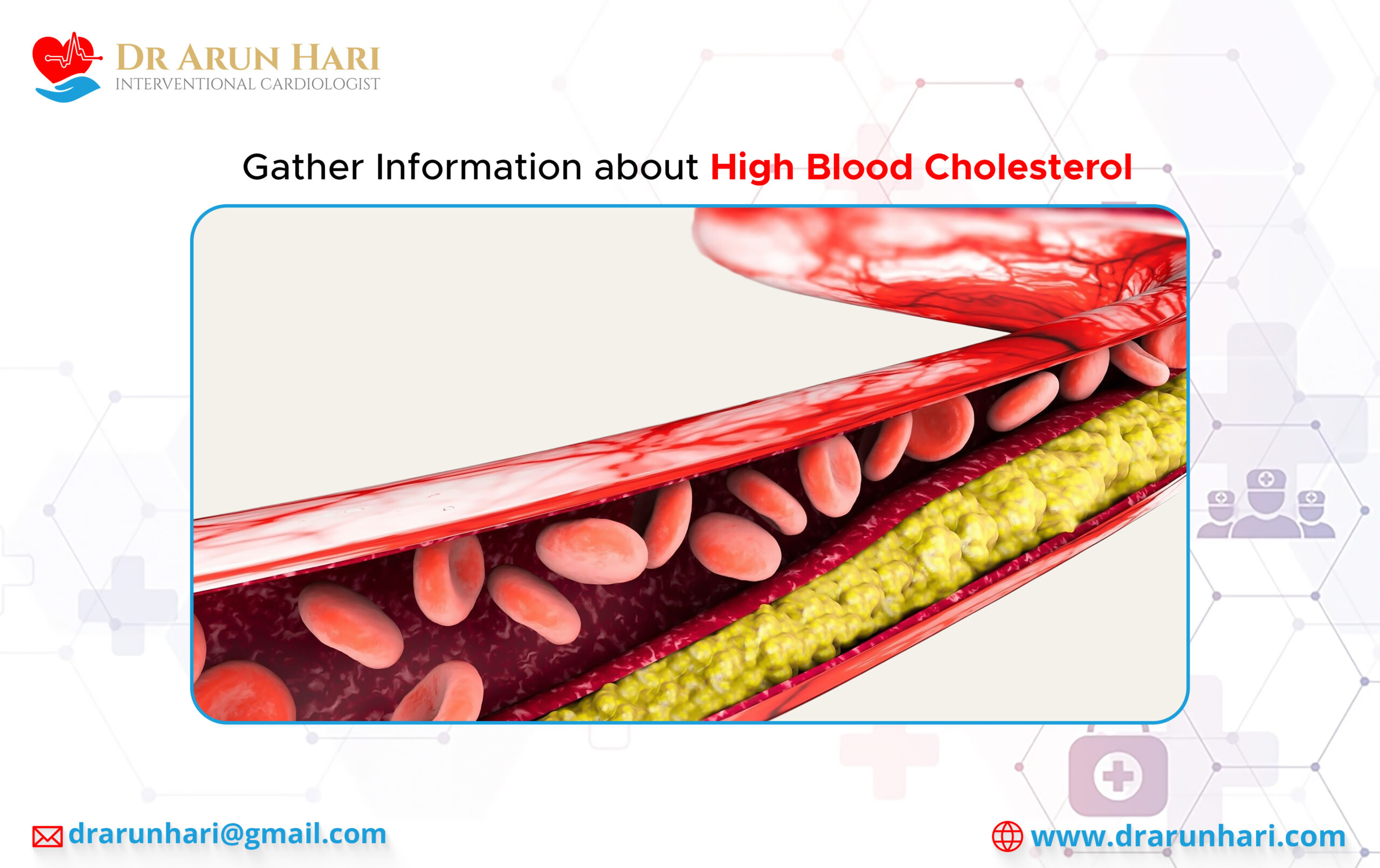 Read more about the article Gather Information about High Blood Cholesterol