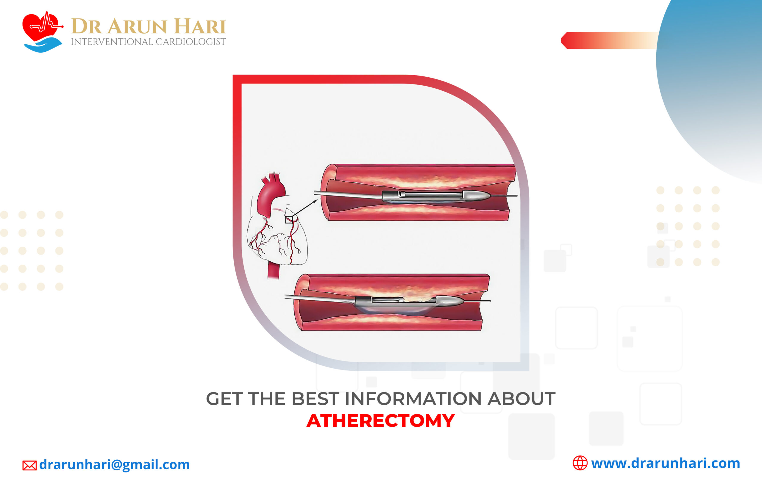 Read more about the article Get the Best Information about Atherectomy