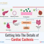 Getting into the Details of Cardiac Cachexia