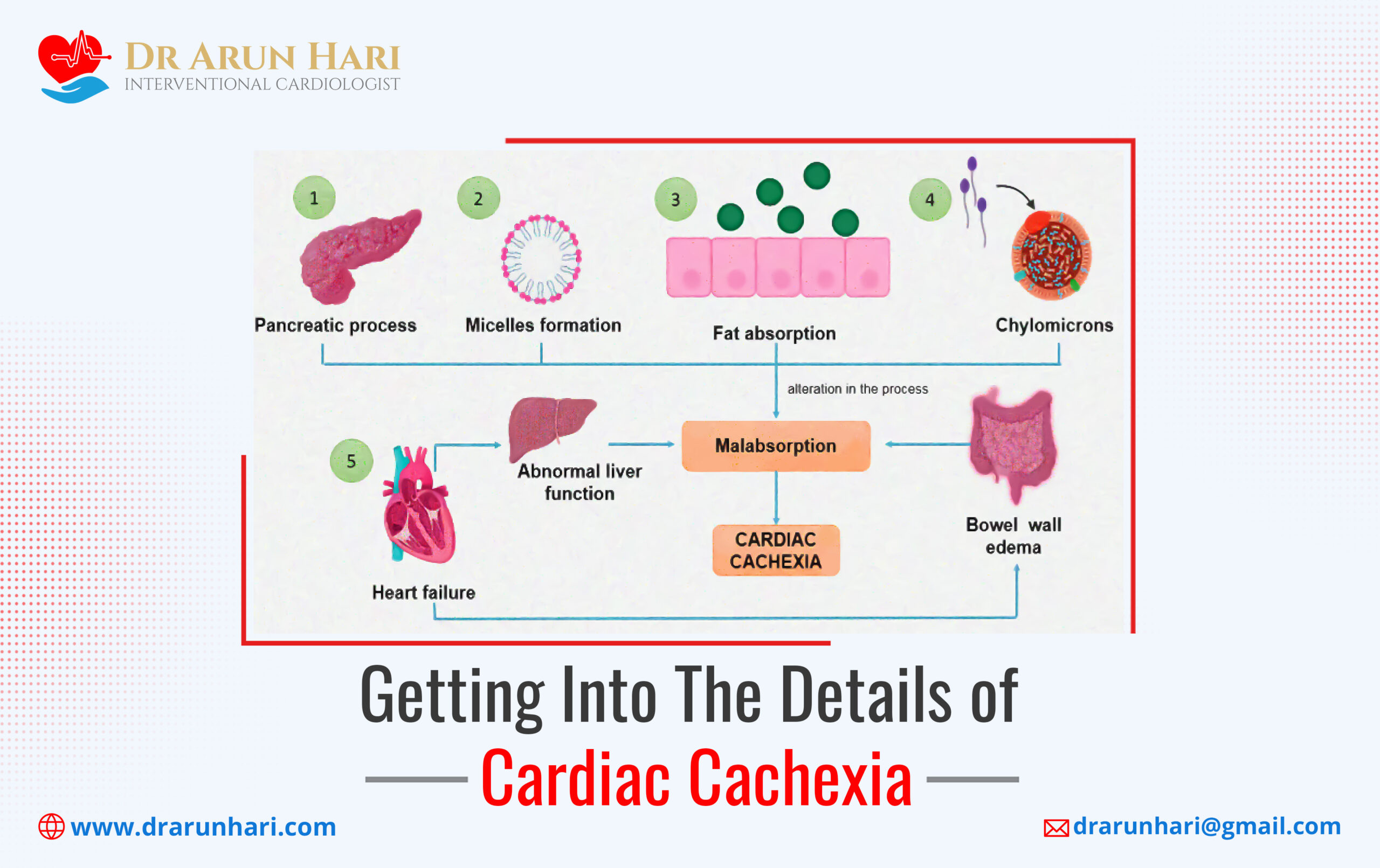 You are currently viewing Getting into the Details of Cardiac Cachexia