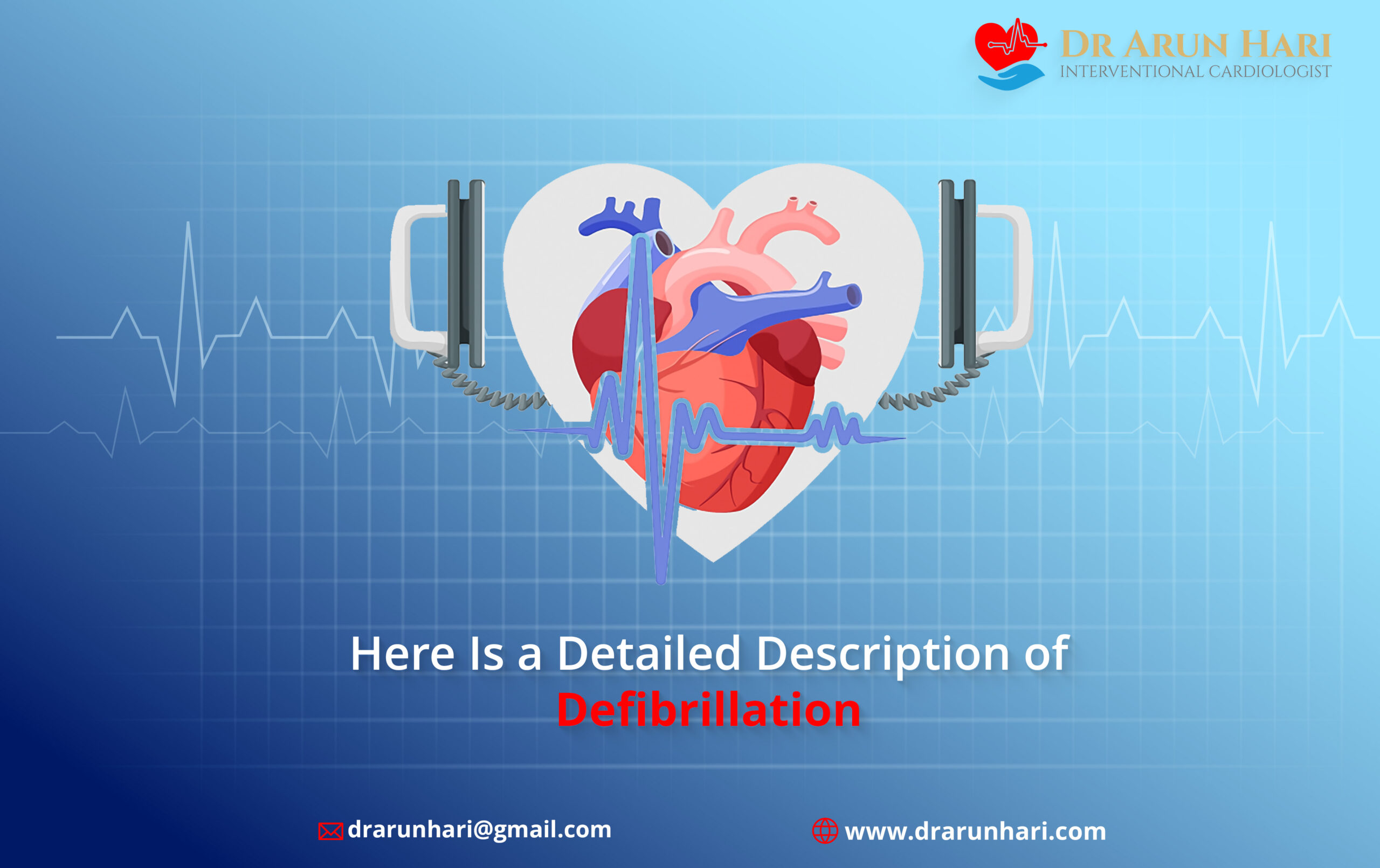 Read more about the article Here Is a Detailed Description of Defibrillation
