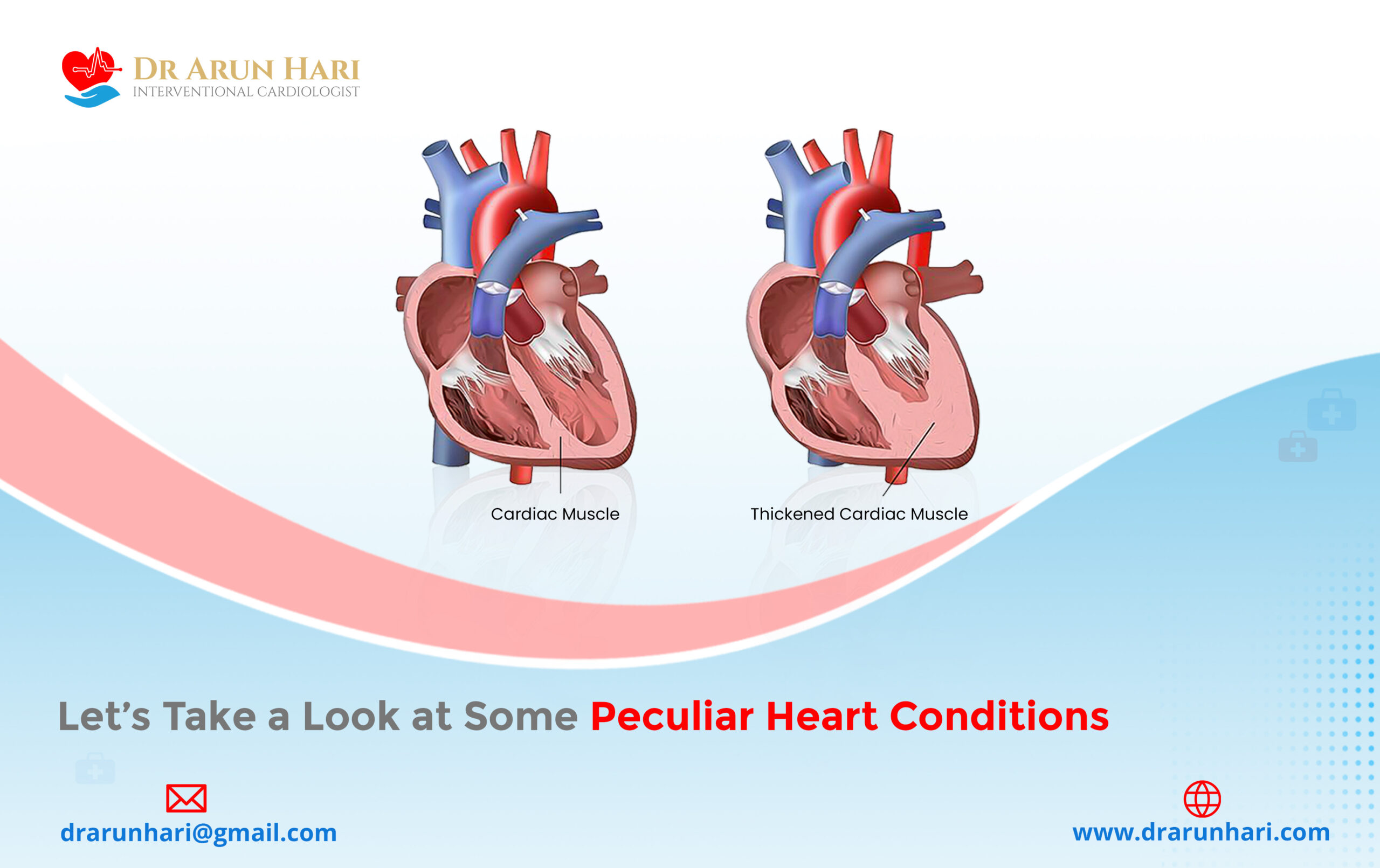 Read more about the article Let’s Take a Look at Some Peculiar Heart Conditions