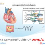 Here’s the Complete Guide on ARVD/C
