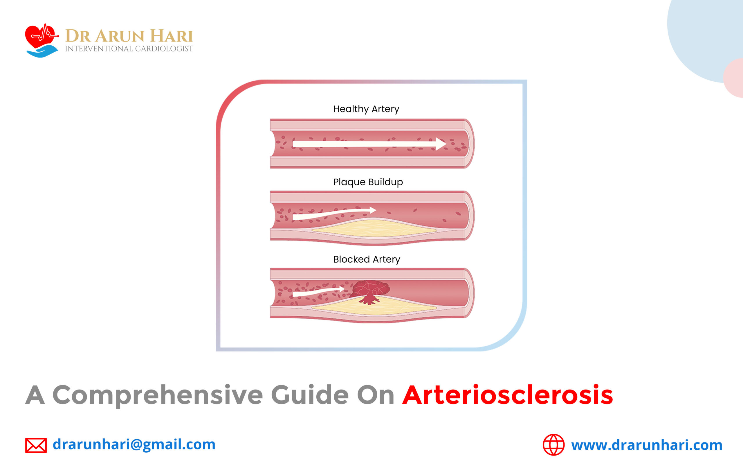 You are currently viewing A Comprehensive Guide on Arteriosclerosis