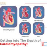 Getting into the Depth of Cardiomyopathy!