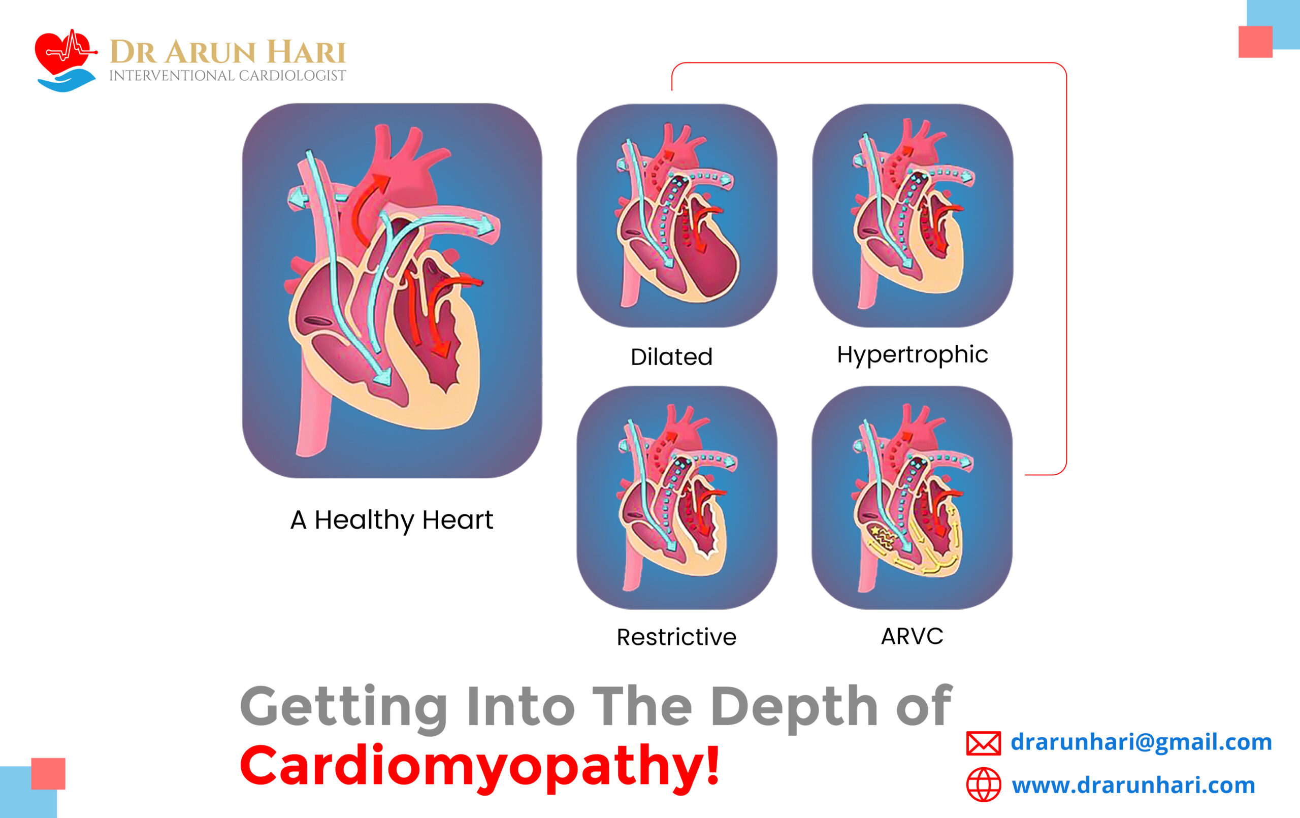 Read more about the article Getting into the Depth of Cardiomyopathy!