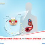 How Are Periodontal Disease and Heart Disease Linked?