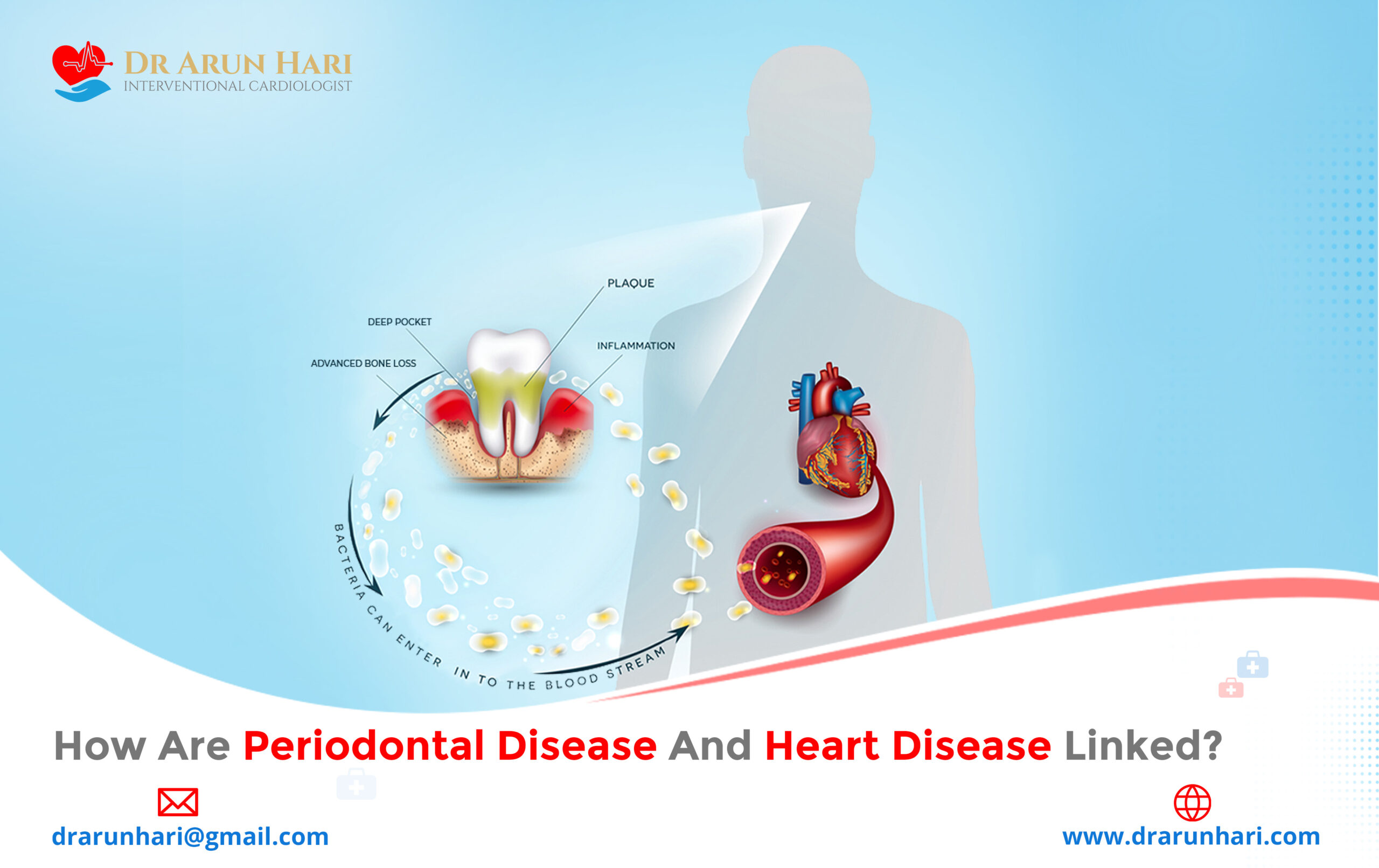 You are currently viewing How Are Periodontal Disease and Heart Disease Linked?