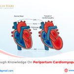 Gain Thorough Knowledge on Peripartum Cardiomyopathy