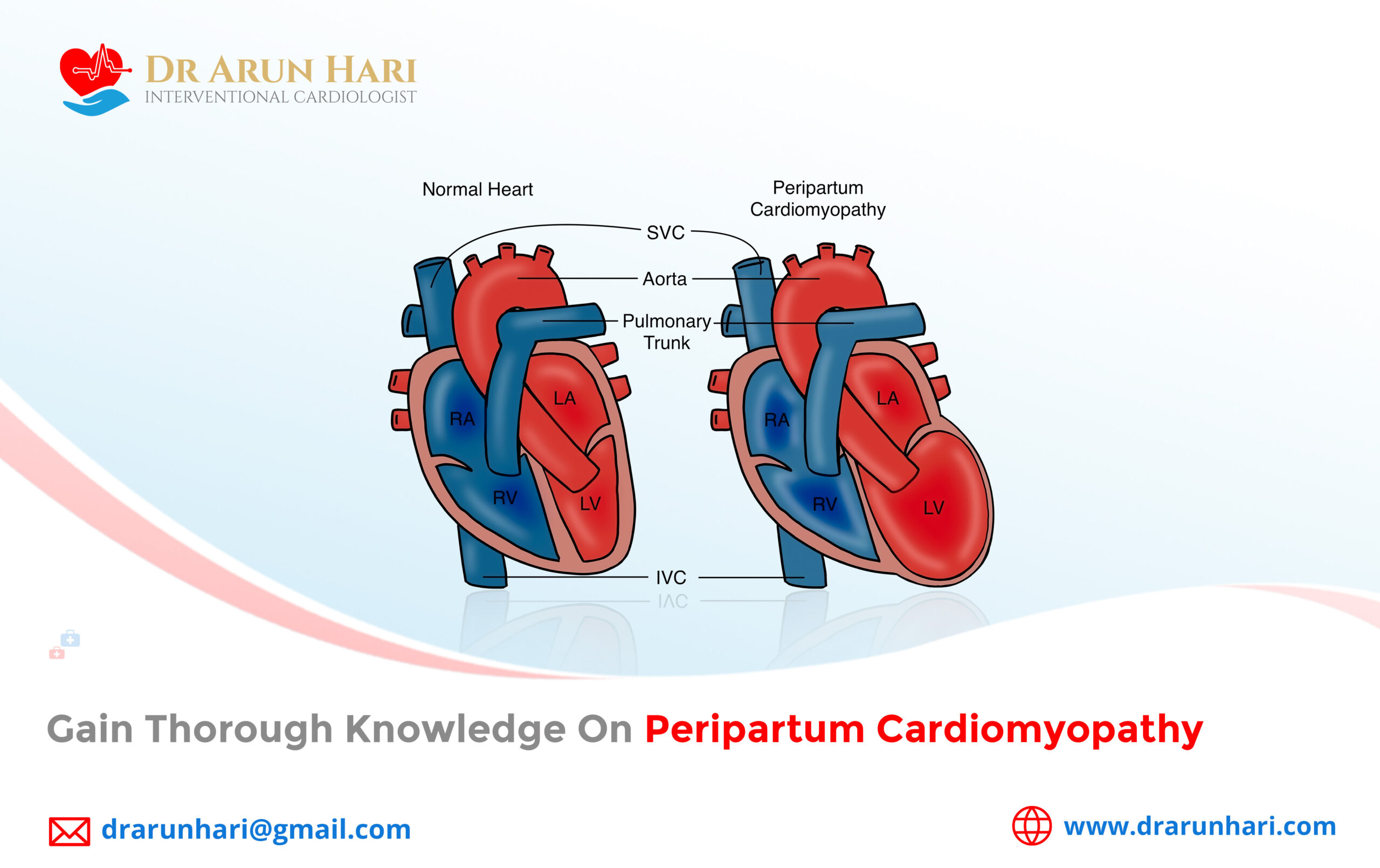 Postpartum Cardiomyopathy: What you need to know - Showit Blog