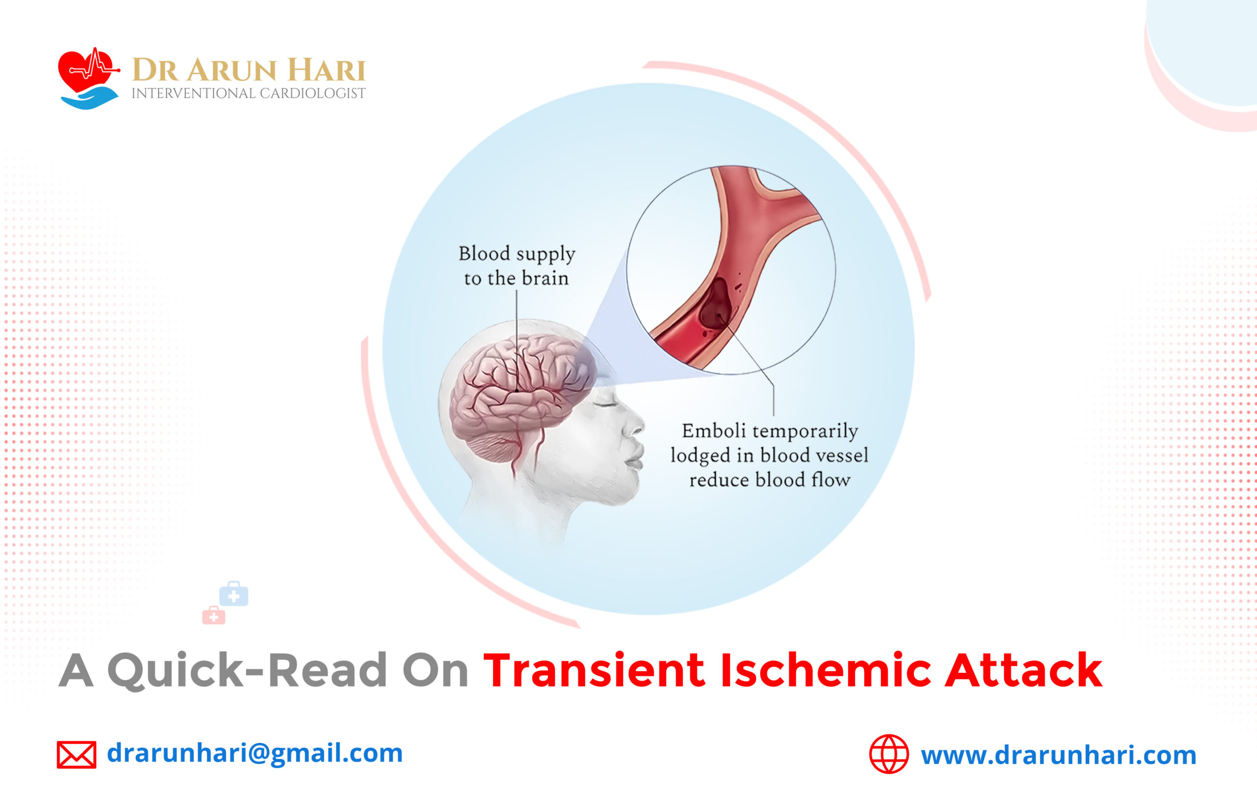You are currently viewing A Quick-Read on Transient Ischemic Attack