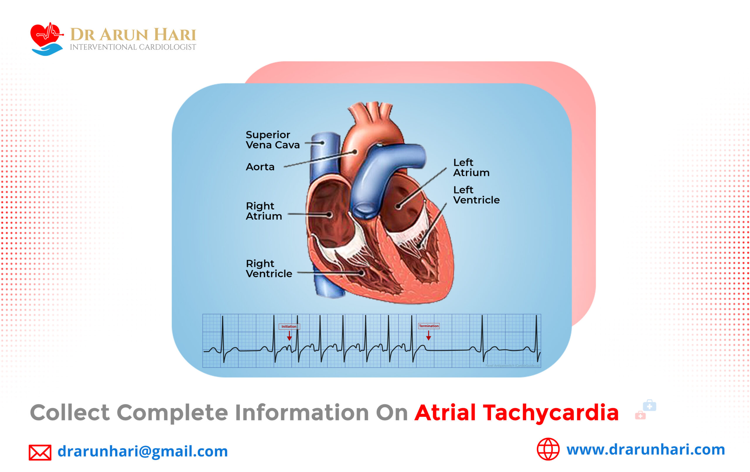 Read more about the article Collect Complete Information on Atrial Tachycardia