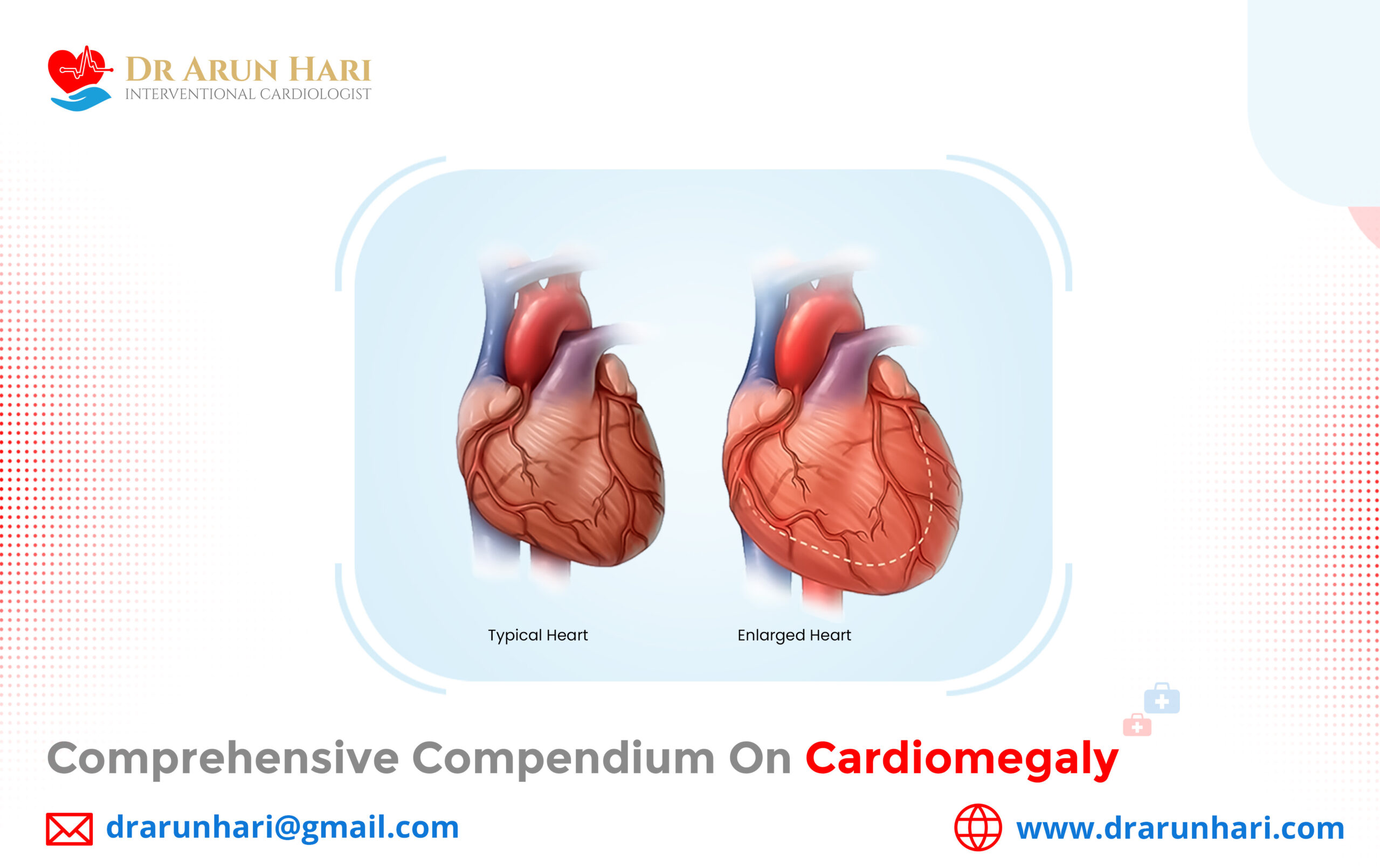 You are currently viewing Comprehensive Compendium on Cardiomegaly