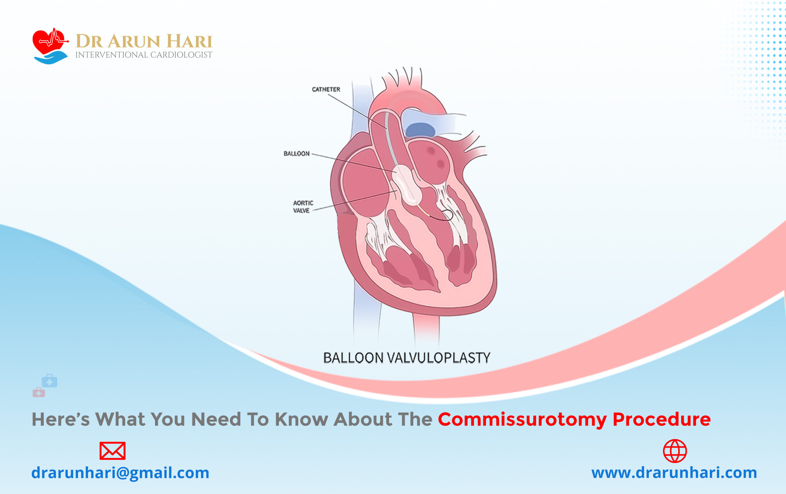 Here’s What You Need to Know about the Commissurotomy Procedure