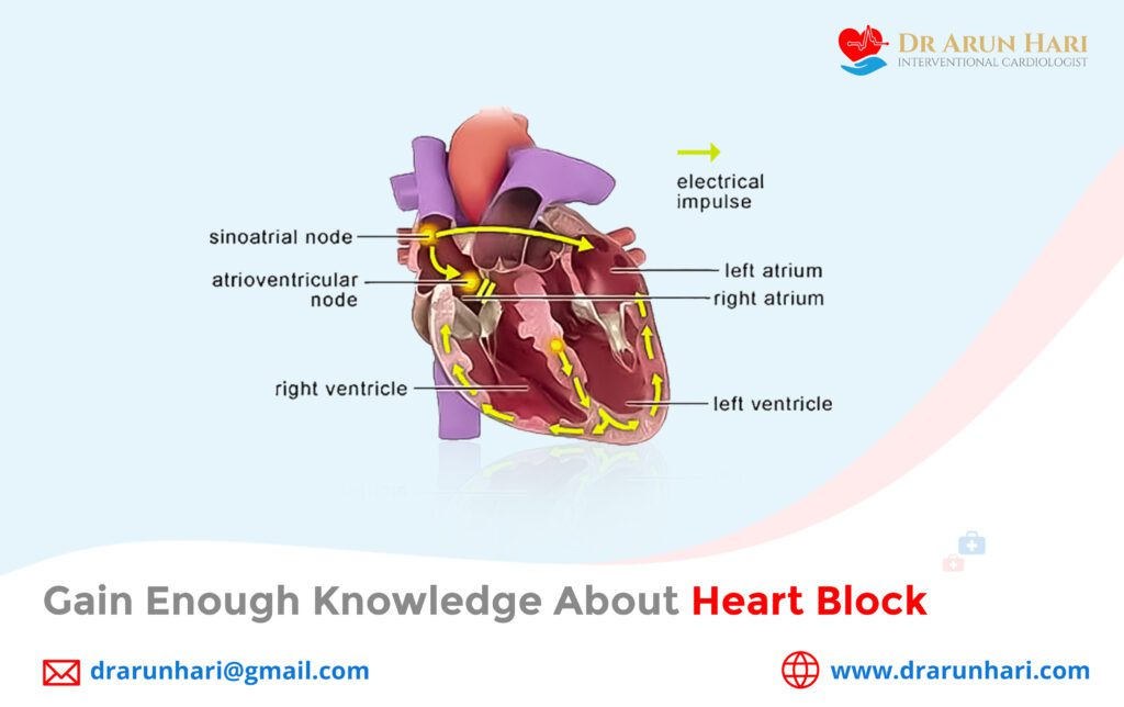 Gain Enough Knowledge about Heart Block