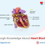 Gain Enough Knowledge about Heart Block