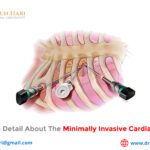 Maximum Detail about the Minimally Invasive Cardiac Surgery