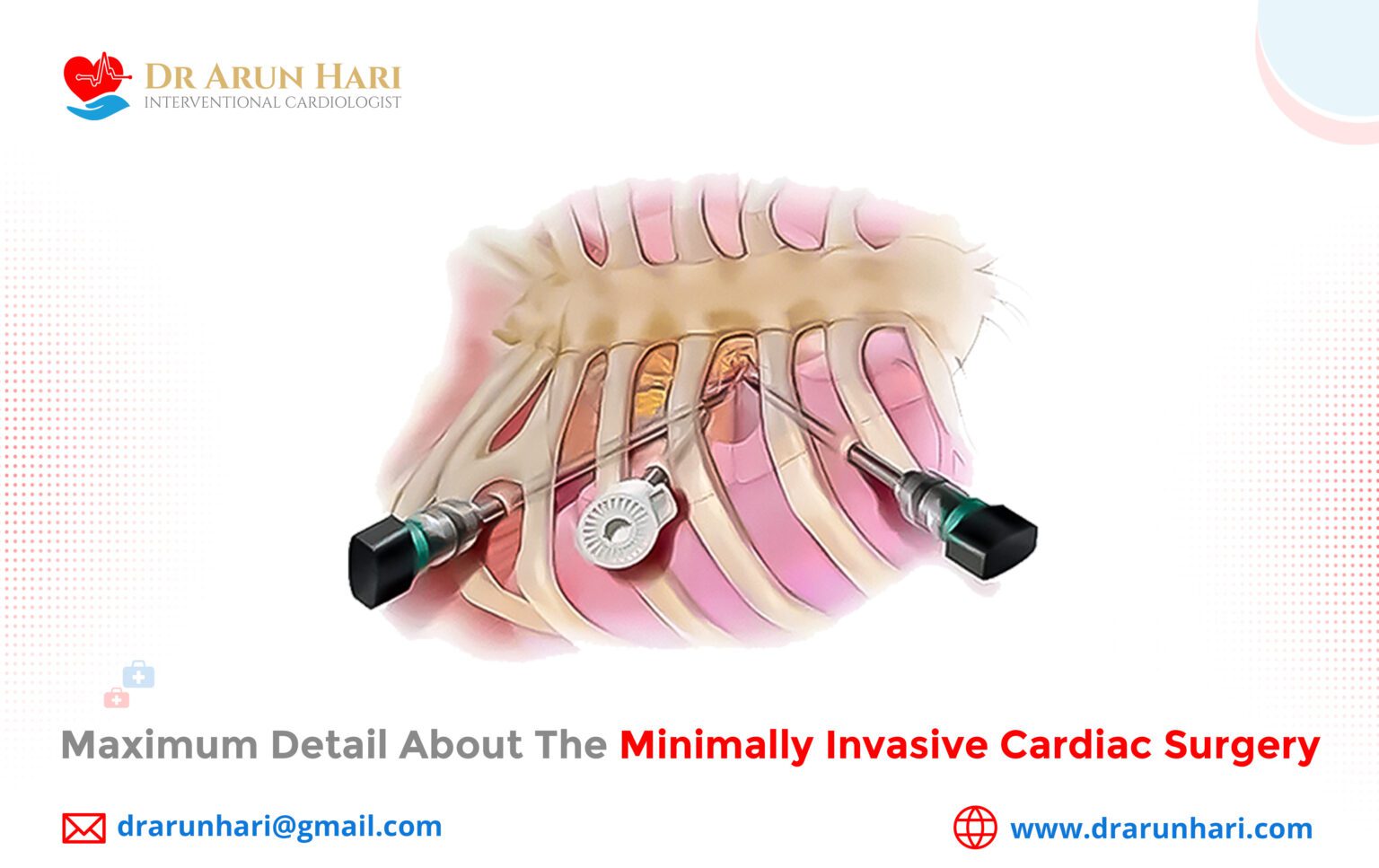 Maximum Detail About The Minimally Invasive Cardiac Surgery - Dr Arun Hari