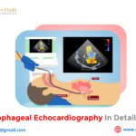 Transesophageal Echocardiography in Detail