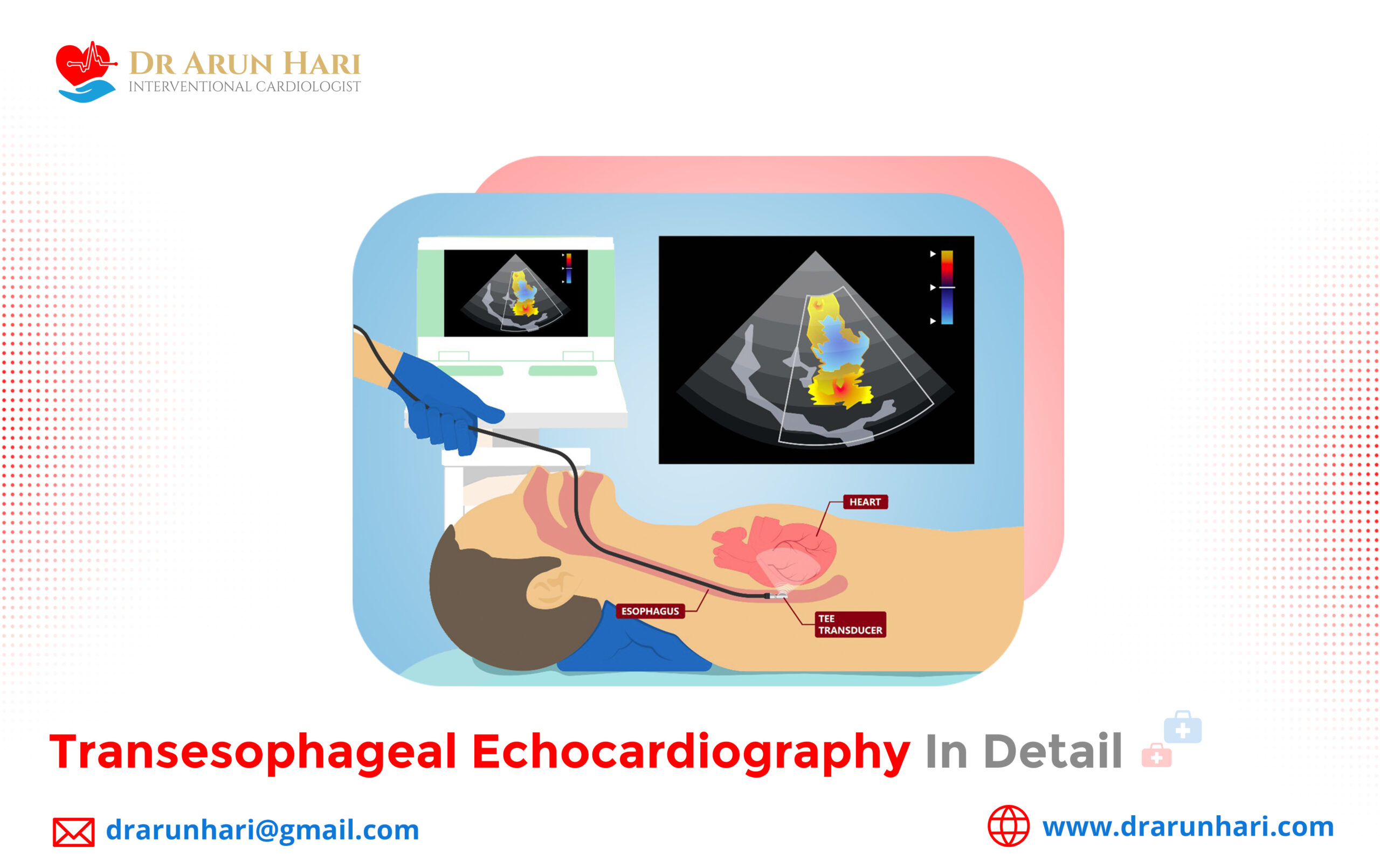 Read more about the article Transesophageal Echocardiography in Detail