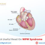 A Useful Read on WPW Syndrome